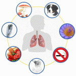 Άσθμα & Τρόπος Ζωής